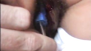 Si fa sverginare con un cacciavite