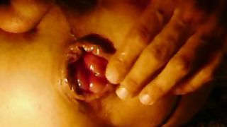 Il mio ano non si chiude piu'... :(