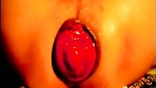 il mio godurioso prolasso