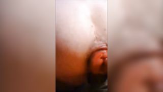 Come si riduce un ano dopo anni di super uso... :)