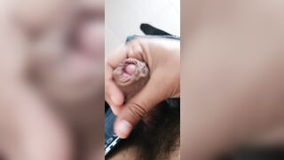 Scappellamento grossa cappella