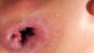 Stimolazione per la stitichezza della maiala