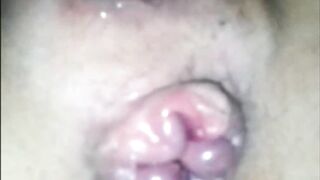 Quanto mi piace quel bottoncino...