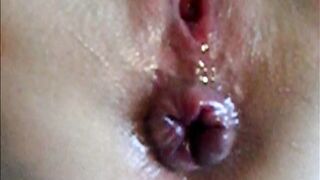 Un magnifico bottoncino...