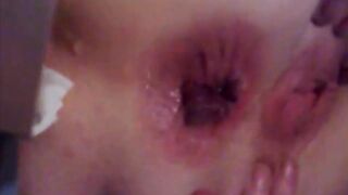 Un magnifico bottoncino...