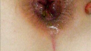 Un magnifico bottoncino...