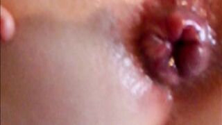 Un magnifico bottoncino...