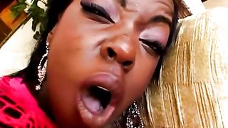 Calda dp interrazziale