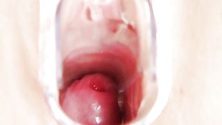 Infermiera con la figa aperta