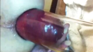 Prolassi artificiali con pompata dell' ano...