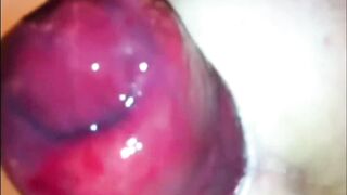 Prolassi artificiali con pompata dell' ano...