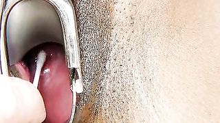 Esame ginecologico bruna hot