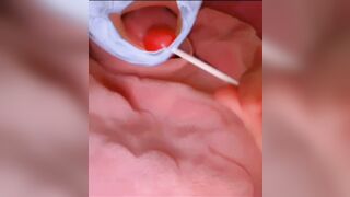 mi ciuccio il bombolone