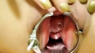 Puttana con la fica da fisting