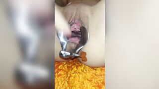 Aperta con lo speculum Fica sfondata