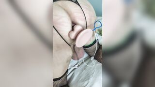 Preparazione buco con scosse elettriche