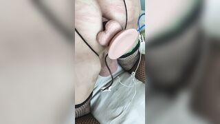 Preparazione buco con scosse elettriche