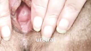 uretral